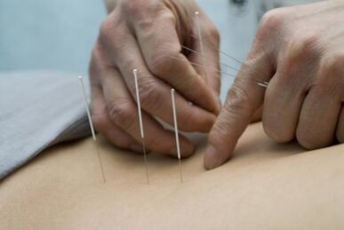 Acupunctura pentru osteocondroza regiunii toracice