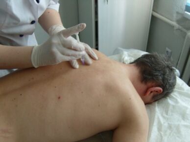 Injecții intraarticulare de condroprotectori pentru osteocondroza toracică