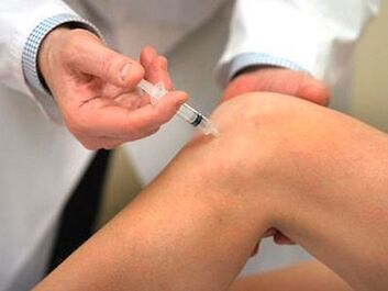 injectare în articulația genunchiului cu artroză